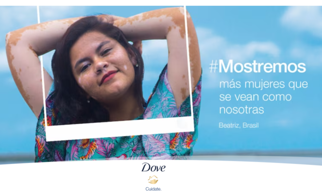 marketing dove